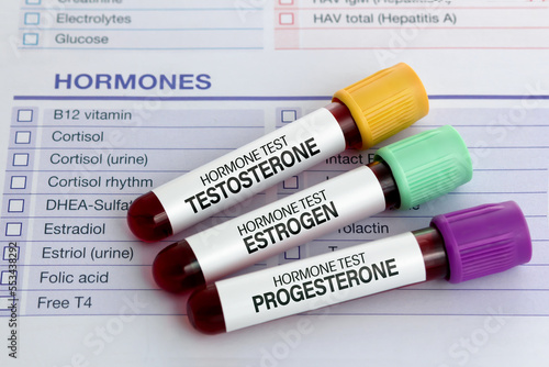 samples of Blood for sexual hormones Analysis Testosterone, Estrogen and Progesterone in men and women. Blood test tubes for Testosterone, Estrogen and Progesterone analysis hormonal 