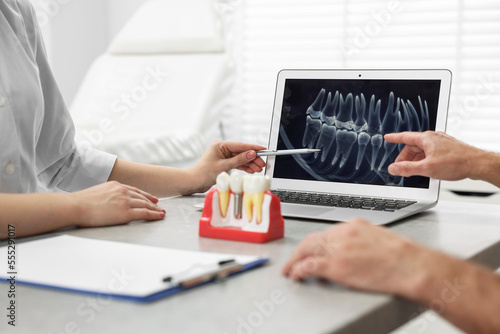 Doctor showing patient X-ray picture and educational model of dental implant in clinic, closeup