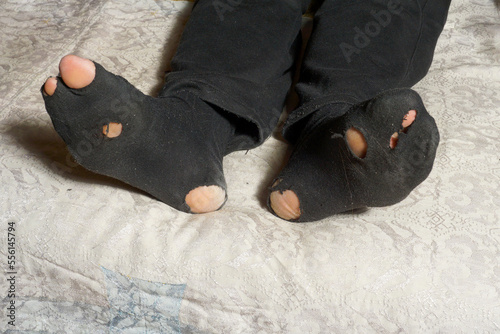 View of torn worn socks on a lying man. The concept of poverty.