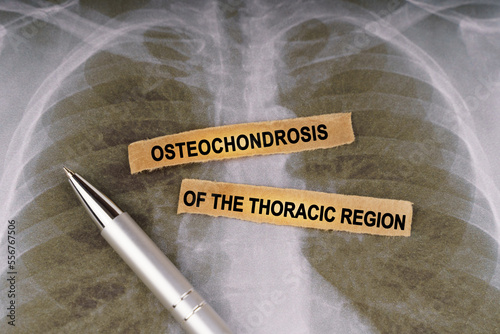 On a human chest x-ray, a pen and strips of paper labeled - Osteochondrosis of the thoracic region