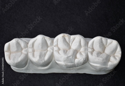 Maxillary premolars and molars in white plaster on a dark background