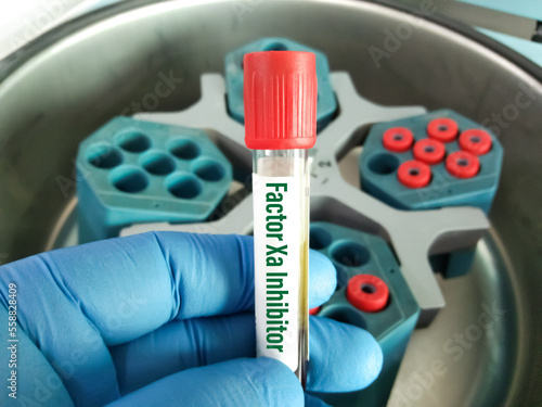 Blood sample for Factor Xa Inhibitor test to diagnosis for clotting disorder. Antithrombin III, AT III, AT 3, Antithrombin test