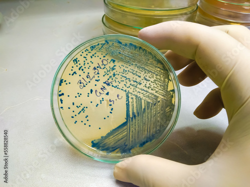 Bacteria colony of Escherichia coli (E.coli) in culture media plate.