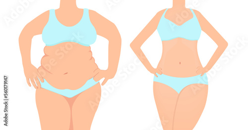 Vector of a woman before and after diet weigh loss.