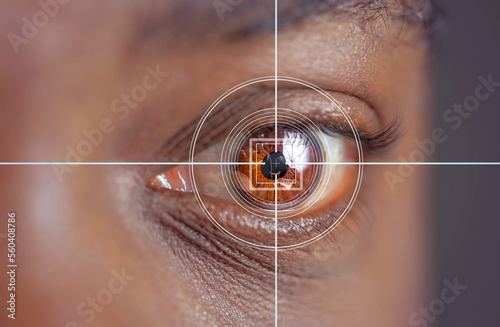 laser and glaucoma eye surgery concept, close up of eye with reticle or target overlay; also useful for conveying lasik procedures