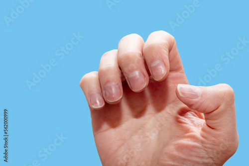 Close-up of a Caucasian female hand with natural unpolished nails, overgrown cuticles on blue background