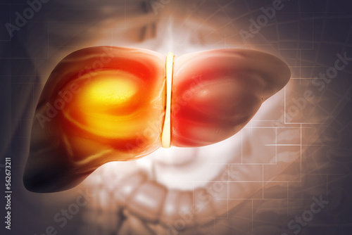 Diseased liver on abstract medical background. 3d illustration