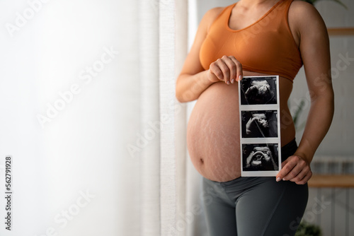 Unrecognizable pregnant woman with stretch marks in comfortable clothes showing her belly and sonographic images of her unborn baby, standing by the window at home during the day.
