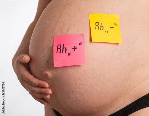 Stickers on the belly of a pregnant girl with inscriptions negative and positive Rh factor. Rh factor compatibility concept, Rh conflict.