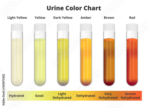 Urine color chart. Vector test tubes with different colors of urine or pee depicting hydrated and dehydrated samples. Light and dark yellow, amber, brown, and red urine. Medical test analysis.
