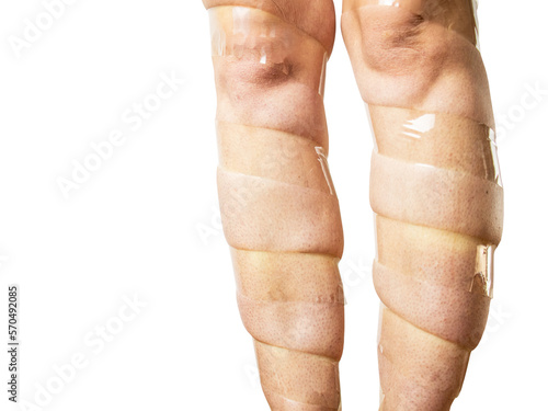 concept of varicose veins, female legs are taped, on a white background, heaviness and discomfort in the leg, leg fatigue when wearing high heels,