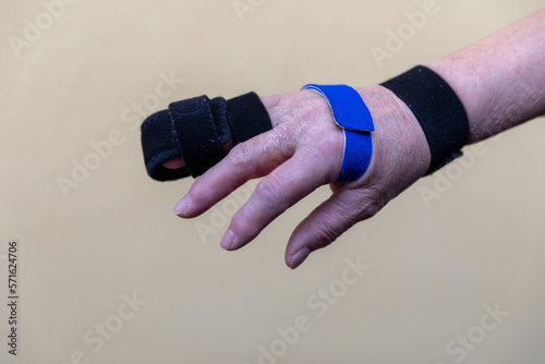 two sided finger splint with two hook and loop straps on a broken finger