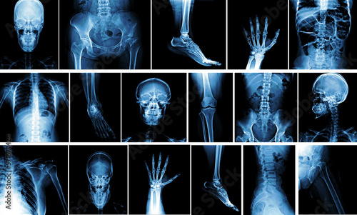 Many x-ray images of very good quality.