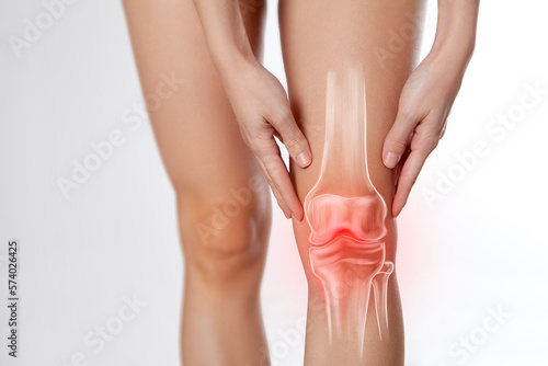 Knee pain, meniscus inflamed, human leg medically accurate representation of an arthritic knee joint. Persistent, sharp discomfort in the knee joint, accompanied by swelling and stiffness