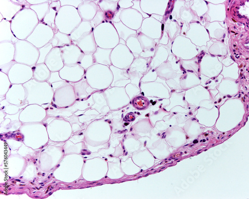 Adipose tissue