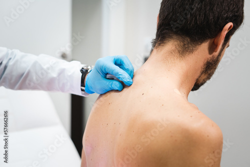 Espalda de paciente siendo examinada por dermatólogo con guantes para observación de lunares