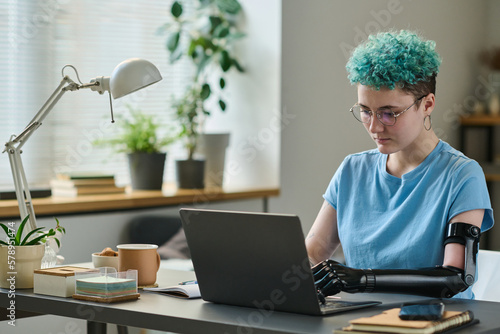 Girl with prosthetic arm working on laptop at her workplace in the room, she having remote work