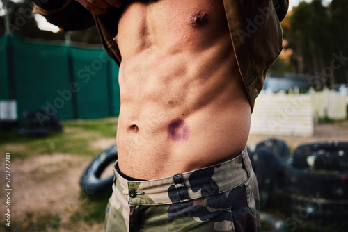Paintball, injury and man with wound on abdomen, military game and extreme sports, accident and injured soldier. Shooting accident, bruise of stomach and pain with camouflage and male on battlefield