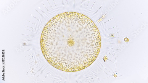 Gossleriella sp, marine phytoplankton from diatom group. Lugol preserved sample. Selective focus