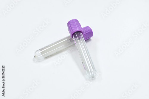 Purple vacuum blood collection tube with EDTA as anticoagulant for Complete blood count test in Medical laboratory.