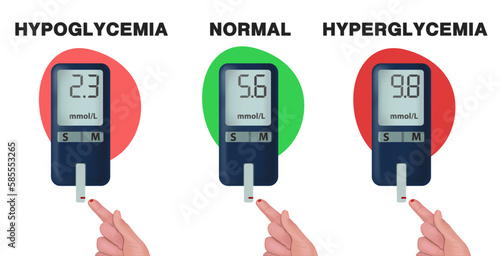 A concept for measuring mmol-l blood glucose levels. Low blood glucose, normal blood glucose, high blood sugar on the glucose meter display. Hyperglycemia, hypoglycemia, normoglycemia. 