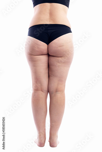 Overweight woman with cellulite and varicose veins in black underwear. Full height. Obesity and disease. Isolated on white background. Vertical. Back view.