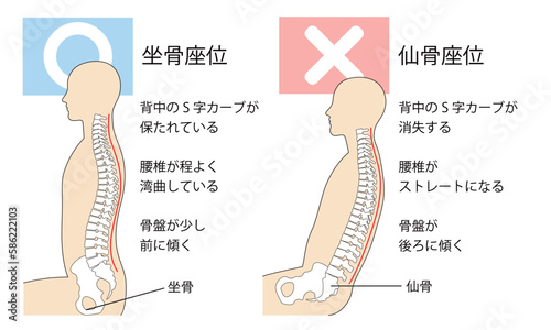 坐骨座りと仙骨座りの比較説明イラスト