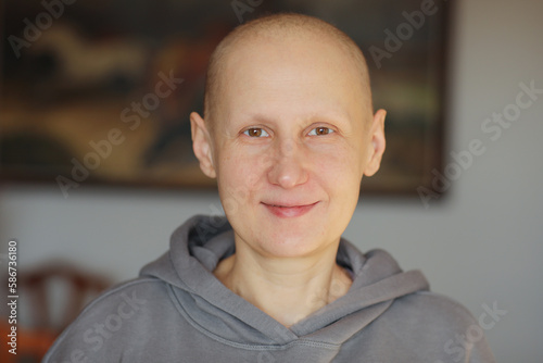 Smiling hairless young female patient struggle with oncology look at camera at home. Bald cancer sick woman after chemotherapy lost her eyebrows and eyelashes feel optimistic of recovery remission