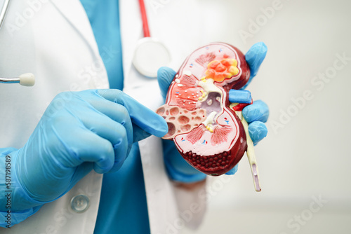 Chronic kidney disease, doctor holding model for treatment urinary system, urology, Estimated glomerular filtration rate eGFR.