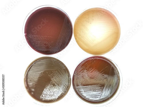 Proteus mirabilis colonies in MacConkey agar plate, Blood agar plate, Chocolate agar plate, and EMB agar plate 