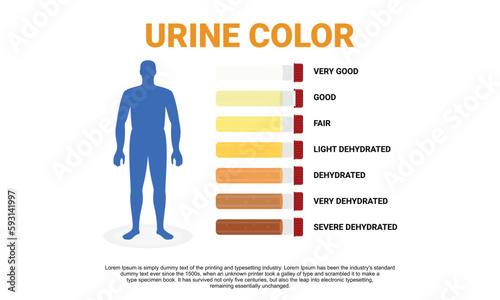 Illustration of urine color chart