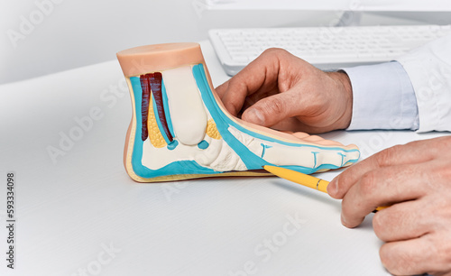 Anatomical flat foot model on doctor table while consultation in orthopedics center. Treatments for flat feet and pes planus