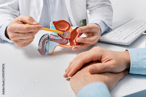 Prostate disease and treatment. Male reproductive system anatomical model in doctors hands close-up during consultation of male patient with suspected bacterial prostatitis