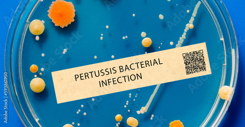 Pertussis (whooping cough) - Bacterial infection that causes severe coughing fits.