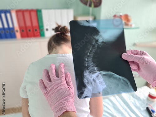 Pediatrician doctor examines x-ray of child spinal deformity