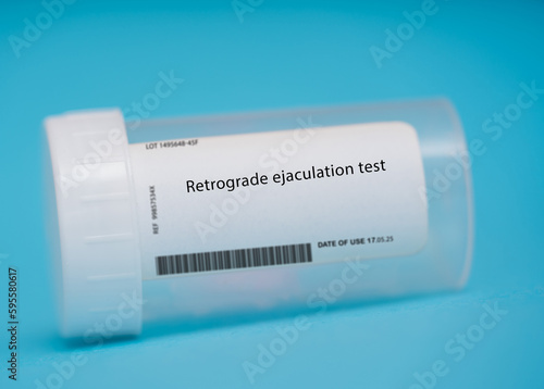 Retrograde ejaculation test