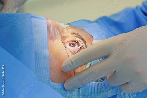 ophthalmology eye surgery excimer laser