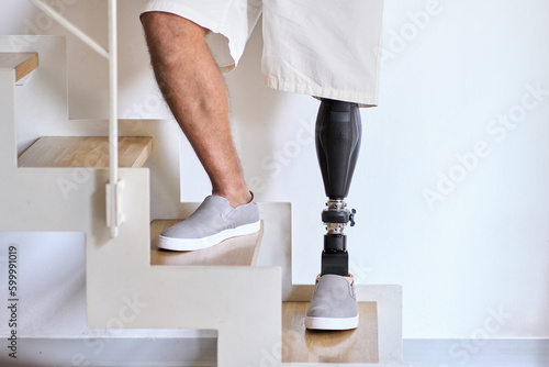 Man amputee with prosthetic leg disability on above knee transfemoral leg prosthesis artificial device stands on feet on stairs, close up. People with amputation disabilities everyday life.