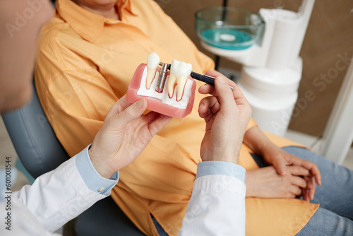 Close-up of unrecognizable dentist holding tooth model while explaining dental implant surgery to patient in clinic