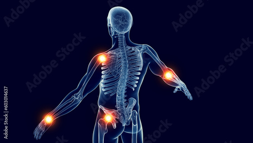 3d medical illustration of a man's joint pain