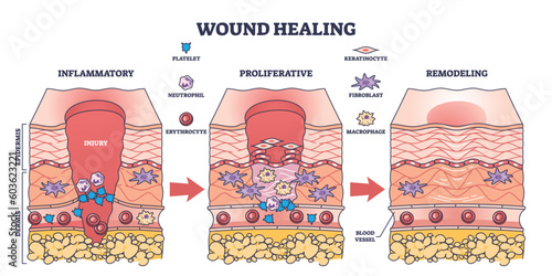 Process of wound healing and anatomical body injury repair outline diagram. Labeled educational scheme with medical epidermis skin inflammatory, proliferative or remodeling stages vector illustration