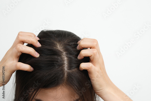 A woman has problems with hair and scalp,she has dandruff from allergic reactions to shampoos. and hair conditioner