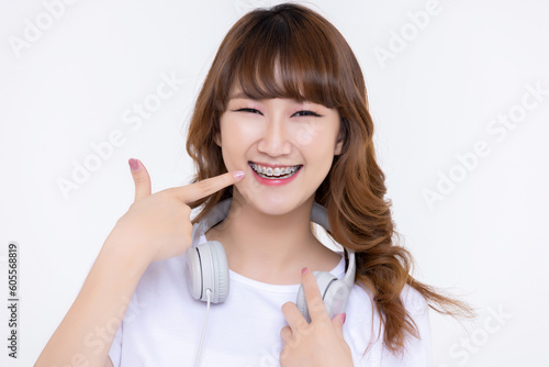 Close up young Asian girl smile and pointing finger to her teeth with braces isolated on white background. Dental care concept.