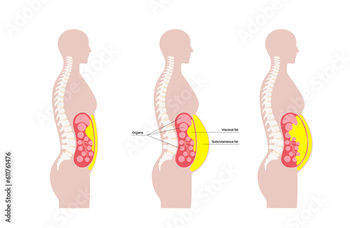 Visceral fat diagram