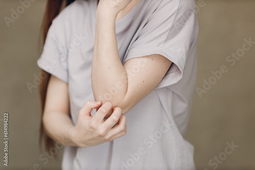 Allergy dermatology scabies itches hand skin problem woman