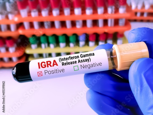 Blood sample for IGRA (Interferon gamma release assay) test.