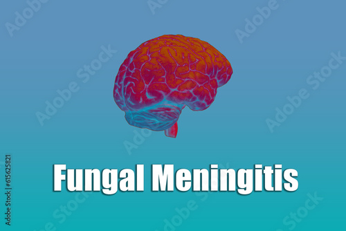 Background of fungal meningitis,Meningitis symptoms,Bacterial meningitis