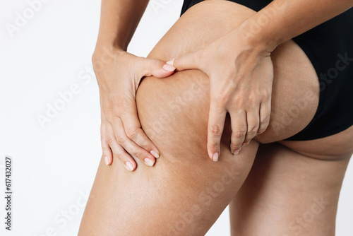 Cropped shot of a young tanned woman in black panties squeezing skin on her thigh with cellulite isolated on a white background. Excess weight, overweight. Flabby sagging skin