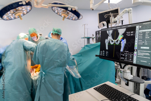 Team of doctor perform total hip arthroplasty replacement surgery in osteoarthritis patient inside the operating room. robot assisted robotic hip and knee replacement surgery 