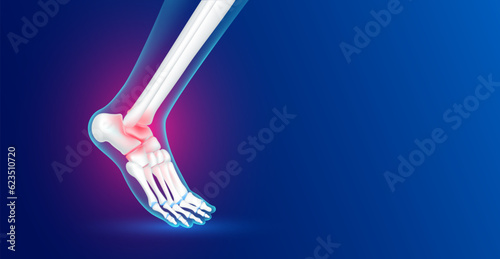 Ankle bone foot traumas and arthritis joint cartilage side on blue background with copy space for text. Human skeleton anatomy healthy. Medical health care science concept. Realistic 3D vector.